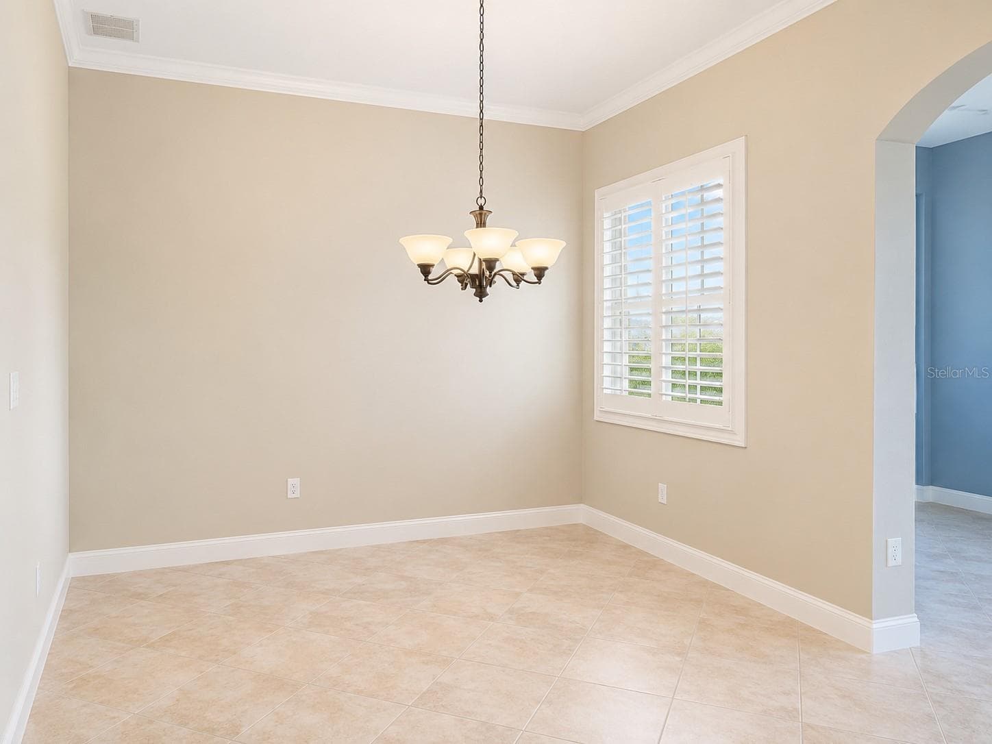 8361 Miramar Way photo 5