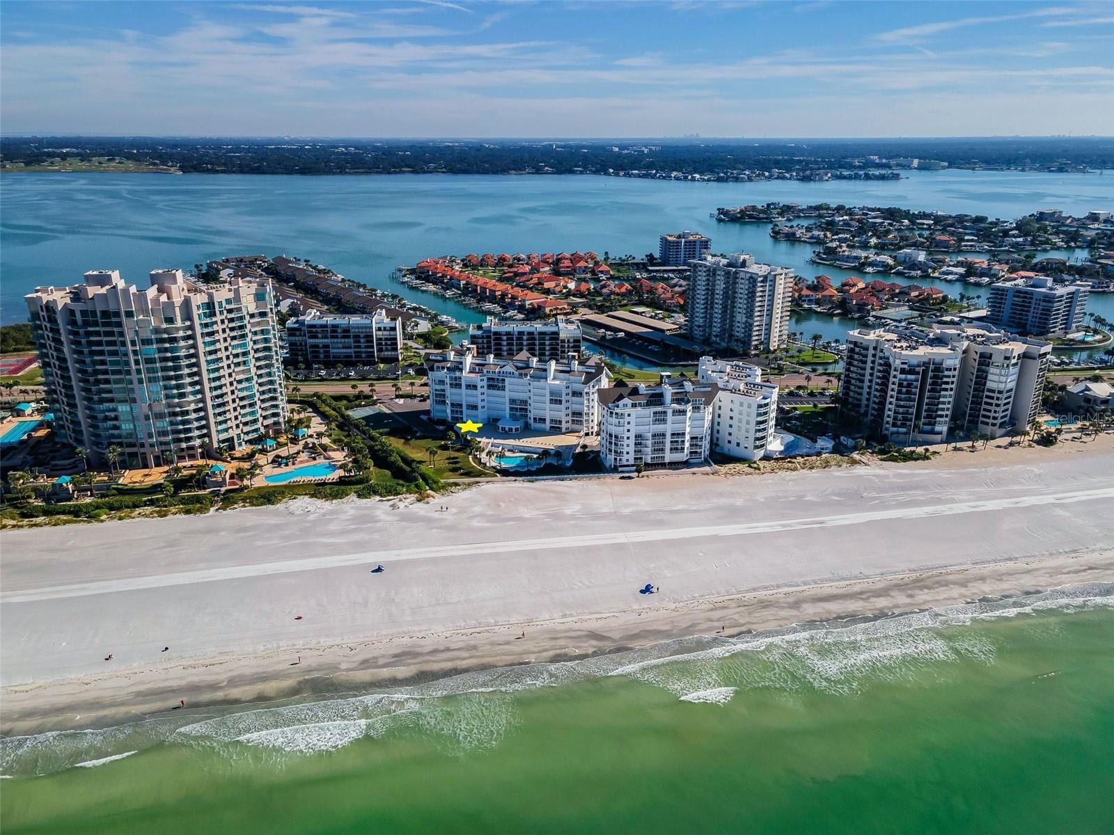 1582 Gulf Blvd #1106 photo 4
